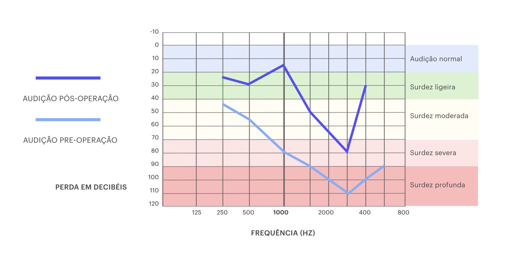 Escala que mede a qualidade da audição